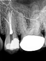 Digital Radiograph